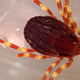 La Hyalomma marginatum vista al microscopio. Se la reconoce porque tiene las patas con franjas de diferente color.
